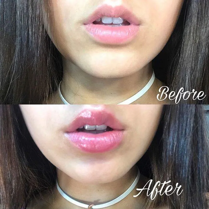 Блеск увеличивающий губы. Помада для увеличения губ. Блеск увеличивающий губы. Блеск увеличивающий губы. Блеск для увеличения объема губ с имбирным маслом ministar.