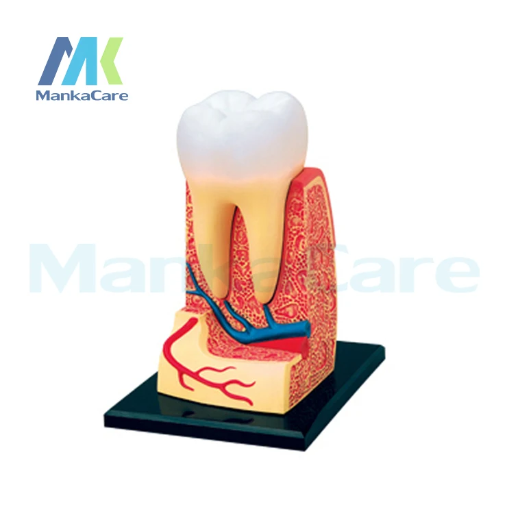 Зубная структура Post Master 4D сборка человеческая анатомическая модель медицинская модель Зуб модель биологический эксперимент