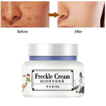 

Freckle Cream Moisturizing Lightening Pigment Dilute Freckle Brighten Skin Color Face Whitening Cream Useful