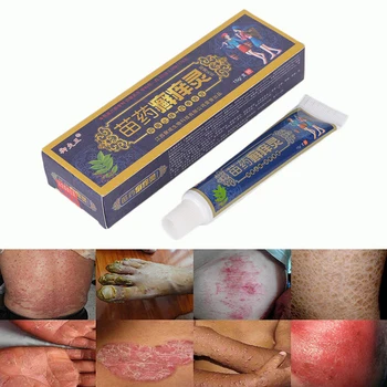 

15g/Box Body Herbal Material Psoriasis Creams and Eczema Psoriasis Ointment Skin Care Health Products High Quality
