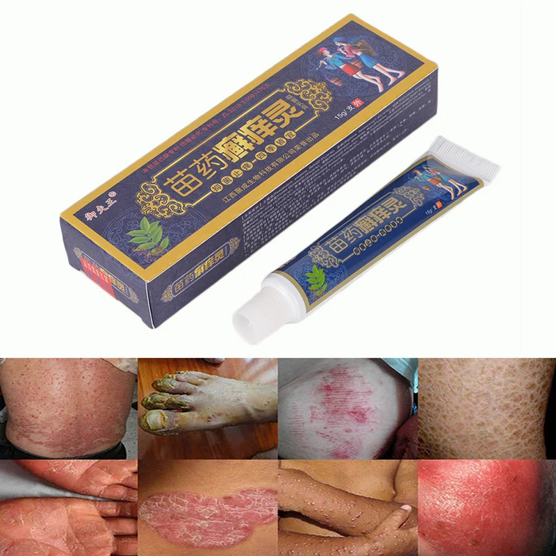 15g/Box Body Herbal Material Psoriasis Creams and Eczema Psoriasis Ointment Skin Care Health Products High Quality 15g/Box Body Herbal Material Psoriasis Creams and Eczema Psoriasis Ointment Skin Care Health Products High Quality