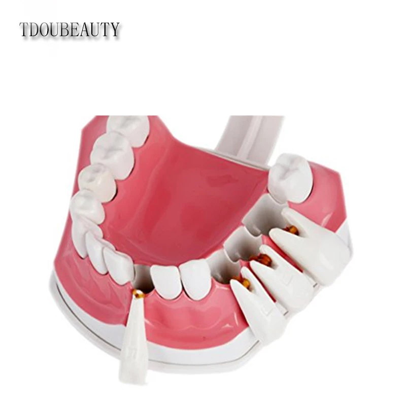 Koop TDOUBEAUTY Volwassen Dental Tanden Model en Tandenborstel met Verwijderbare Hoogwaardige Tanden Onderwijs Model gratis verzending