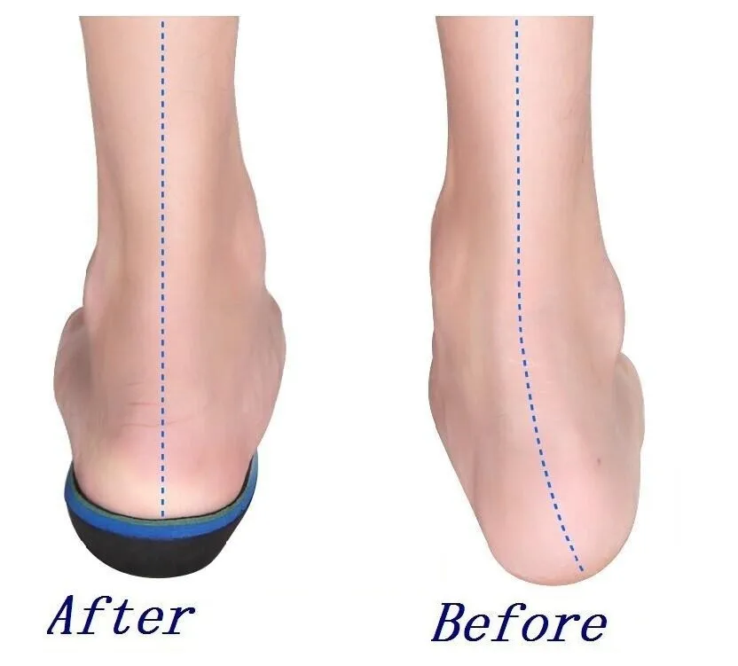 orthotic sandals for high arches orthopedic insoles for flat foot high arch supports orthotic sandals for high arches orthopedic insoles for flat foot high arch supports