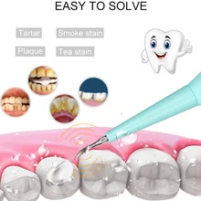 Прямая поставка Портативный электрическая звуковая детали стоматологического аппарата для снятия зубного камня зуб Blanqueador здоровье гигиена полости рта жидкость для снятия от зубных пятен зубного камня инструмент Стоматолог