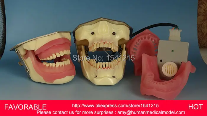 

DENTITION MODEL, TEETH DENTAL DENTURES DENTAL TEACHING TOOTH MODEL DENTAL TEETH MODEL, ORAL CARE MODELGASEN-DEN008