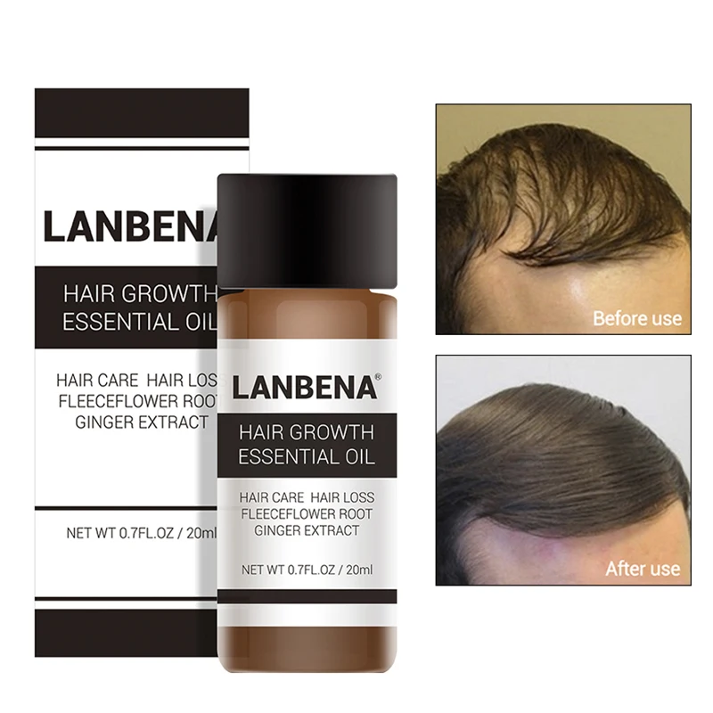 LANBENA средство для роста волос быстро Мощный Уход за волосами эфирное масло жидкость лечения Для мужчин t предупреждающий потерю волос Для