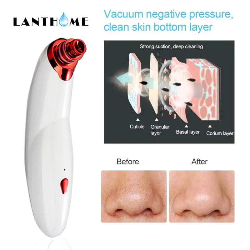 

Blackhead Cleaner Extractor Black Dots Spot Cleaner Acne Blemish Pimple Remover Skin Care Tool Pore Vacuum 5 Types Suction Heads