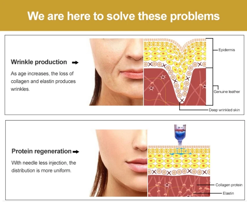 Hyaluronic Acid Pen detail 1 (7)