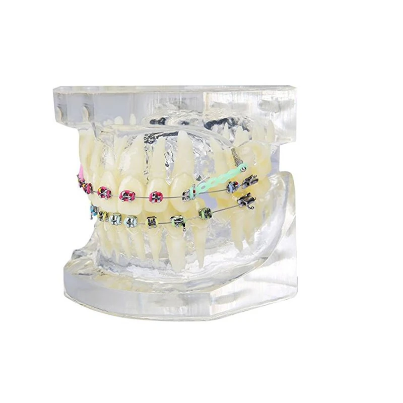 

1 Pcs Dental Study Transparent Teeth Model Standard or Malocclusion Orthodontic Model Brace Brackets Typodont