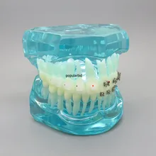 BLUE Dental Orthodontics Communication Model With 4 Types of Brackets