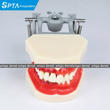 

teeth Model Dental Periodontal Disease Practice Dental Model With tartar