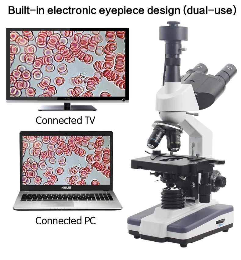 Профессиональный цифровой бинокулярного микроскопа 40-1600X 7-дюймовый ЖК-дисплей экран спермы клещей капли крови, контрольно-измерительный прибор Биологический микроскоп