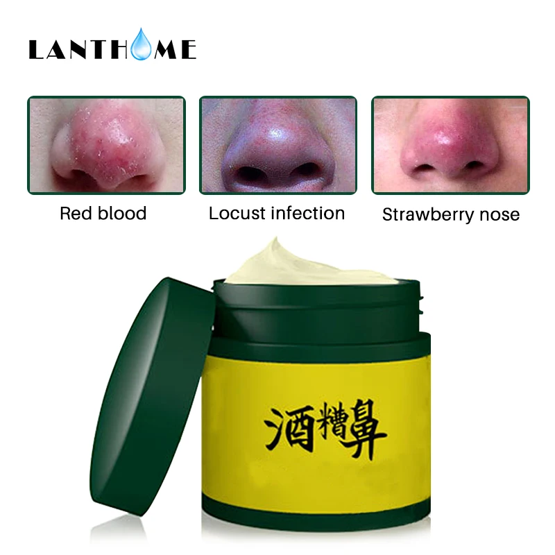 Herbal Medicine Rosacea Cream Treatment Acne Rosacea Red Nose Acne Scar