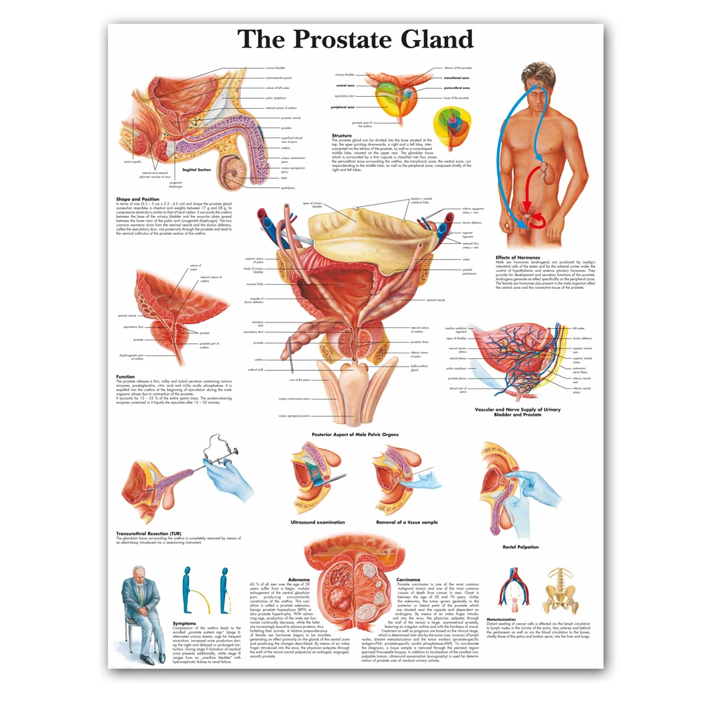 

WANG ART back to school Prostate Gland Anatomical Charts Posters Anatomy Canvas Print Wall Pictures Medical Education Office