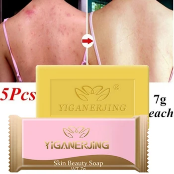 

5pcs Sulfur Soap Oil-control Acne Treatment Blackhead Remover Soap Whitening Cleanser Skin Care