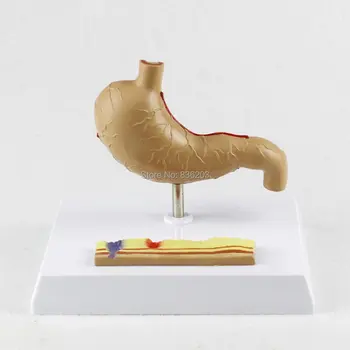 

Human traumatic pistol skeleton trauma medical instruments Stomach with Ulcers anatomy Anatomical Display Science Teaching model