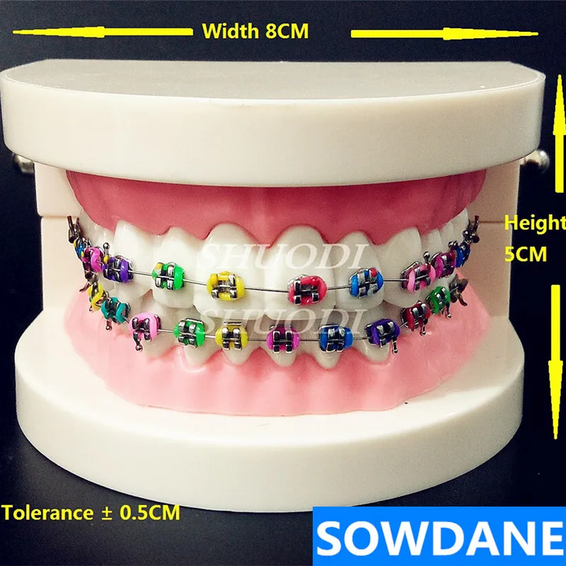 

Dental Orthodontic Treatment Model With Ortho Metal Bracket Arch Wire Buccal Tube Ligature Ties