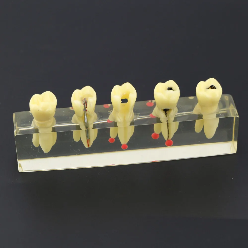 Стоматологическое Эндодонтическое лечение демонстрационная модель 4012 Исследование Обучение модель зубов