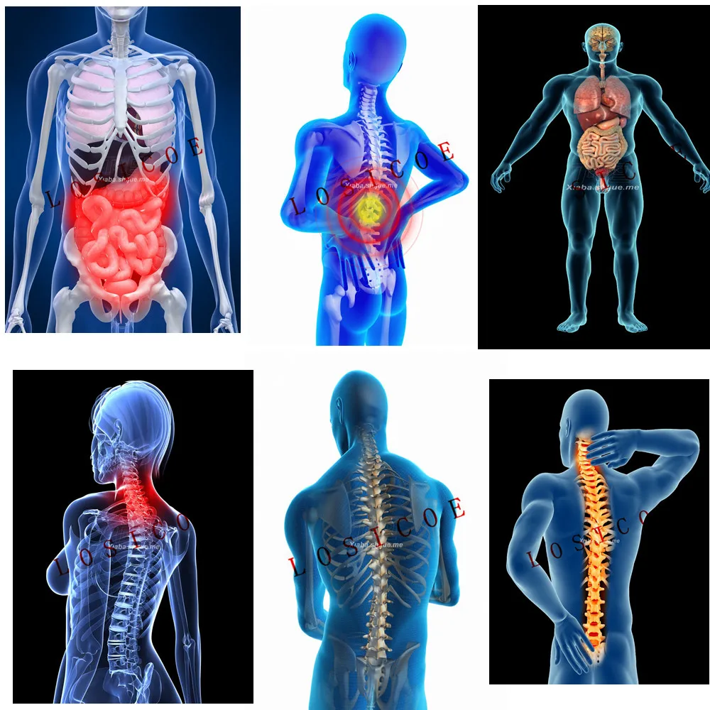

3D X-ray Scanning Human Man Anatomy Shabby chic Vintage Inkjet printing kraft paper poster Wall Stickers Home Decoration