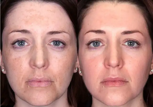 aha glycolic acid aha glycolic acid
