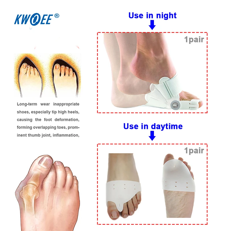 

2 Pairs/set Hallux Valgus Aligner Toe Corrector Toes Care Foot Thumb Big Toe Separator Hallux Valgus Toes Separator Support