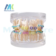 Manka care-24 шт., все керамический кронштейн устные модель зубы модель