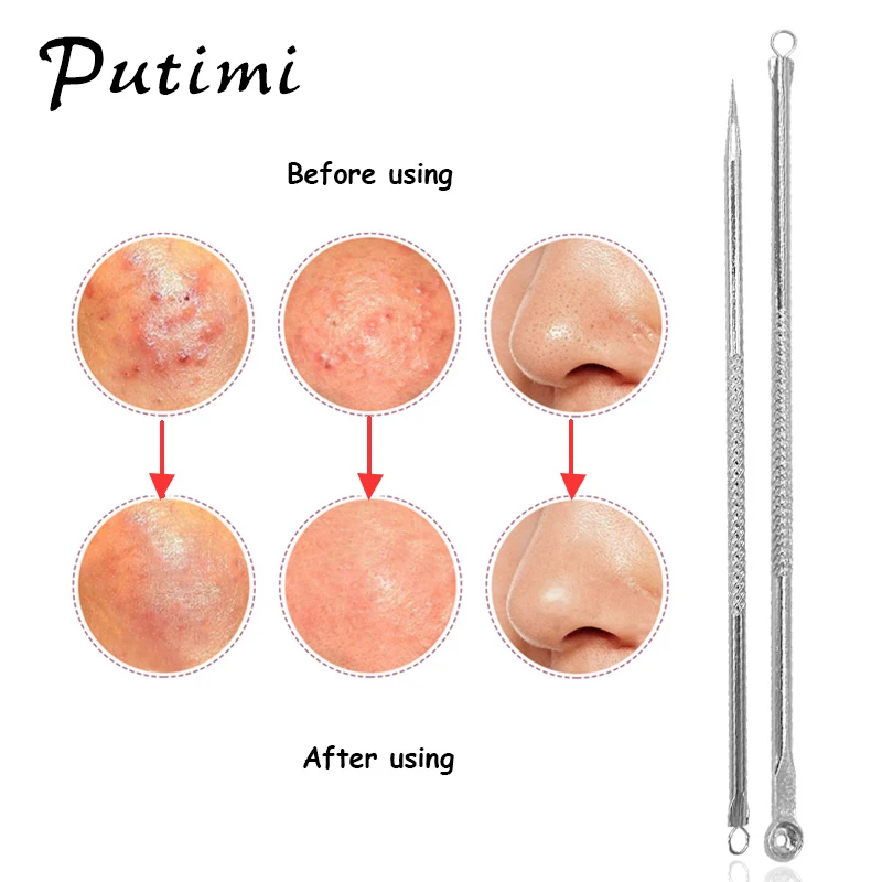 Putimi 2 шт чёрные точки пятно пульверизаторы игла для удаления акне прыщи инструмент для удаления дефектов кожи инструмент для очистки пор инструмент от акне на лице уход за кожей лица
