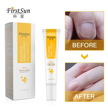 

Herbal Fungal Nail Treatment Essential Oil Hand and Foot Whitening Toe Nail Fungus Removal Infection Feet Care Polish Nail Gel