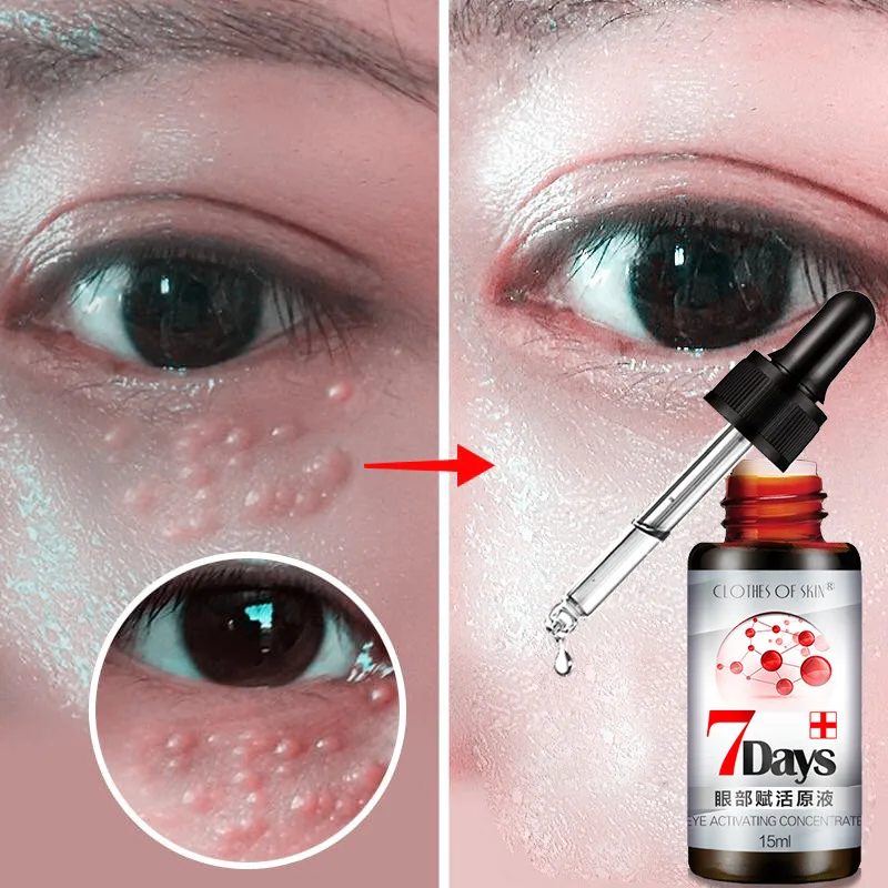 

Newest Anti-Puffiness Remove wrinkles Eyes Serum Remove Fat Granule Dark Circle Anti-Aging Moisturizing Eye Cream