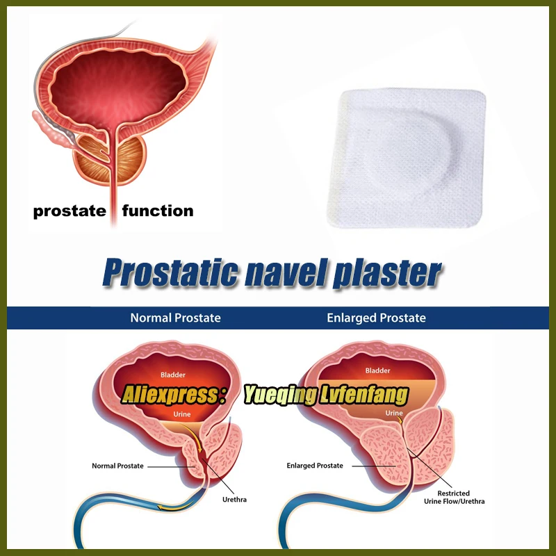 20 шт трав простатический пластырь на пупок простатит урологический пластырь простатит Китайский травяной пластырь