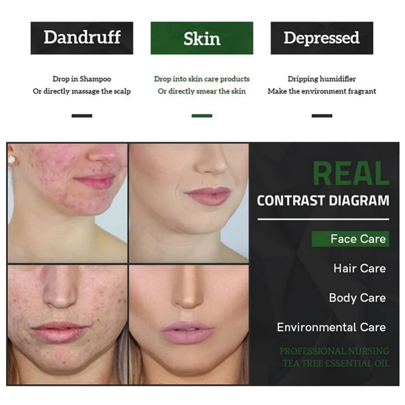 Масло чайного дерева увлажняющее антиакне противовоспалительное осветляющее