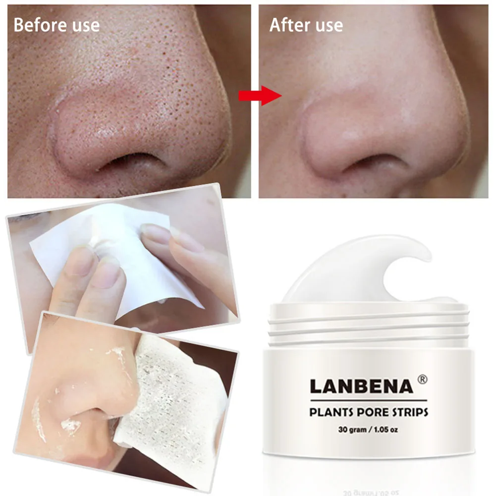 

LANBENA Facial Mask Acne Remove Blackhead Mite Propolis Face Nose Care Treatment Repair Moisturizing Cream 30g HB88
