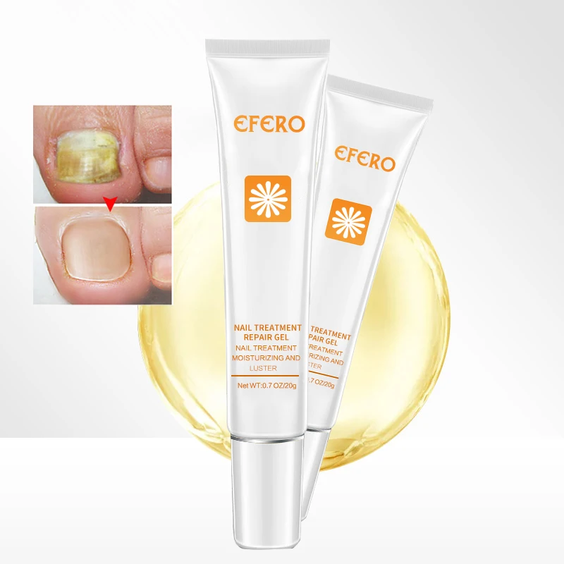 EFERO Nail Repair Essence Serum Toe Nail Fungus Onychomycosis Removal Treatment Nail Care Essence Anti Fungal Nails Repair Cream