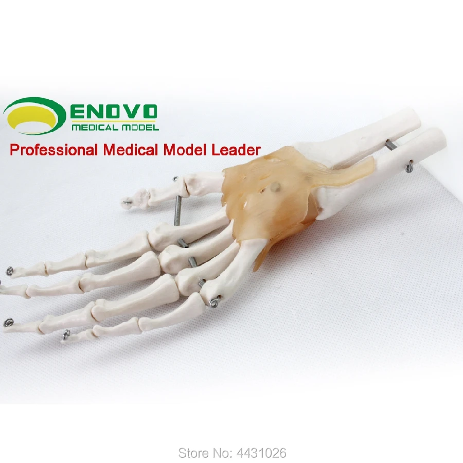 Enovo Medizinische Menschlichen Hand Articular Bander Modell Hand Knochen Ulnaris Radius Menschliches Skelett Fuss Chirurgie Medical Science Aliexpress