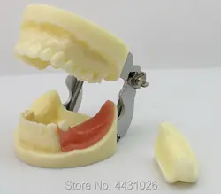 ENOVO полости рта посадки модели стоматологической хирургии модель обучения зубные стоматология Имплантат практика экспертизы