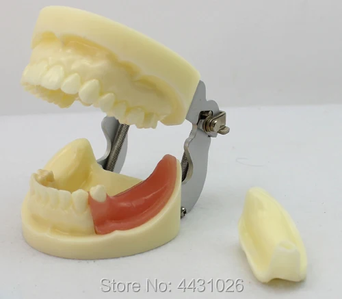 ENOVO Oral cavity planting model dental surgery teaching model dental dentistry dental implant practice examination ENOVO Oral cavity planting model dental surgery teaching model dental dentistry dental implant practice examination