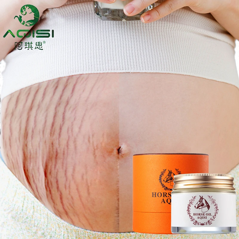 

Smooth Skin AQISI Horse Oil Cream for Stretch Marks Scar Removal To Maternity Skin Repair Body Cream Remove Scar Care Postpartum