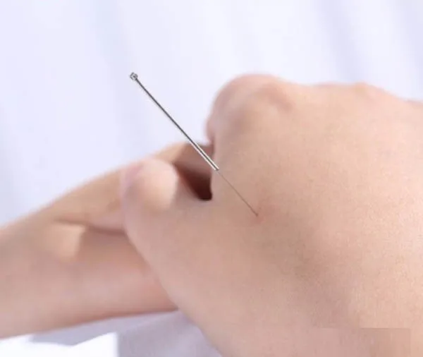 Hot selling Sterile Acupuncture Needle Massage Needle Disposable