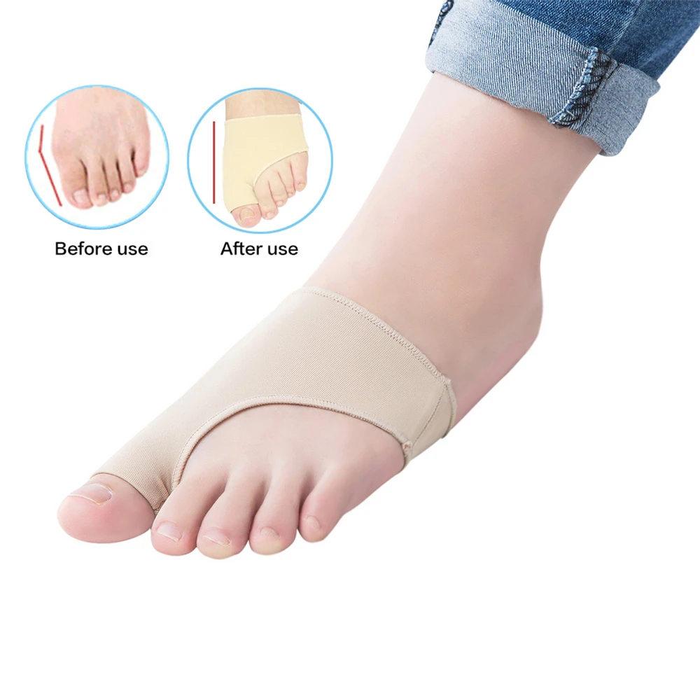 

1pair Bunion Toe Separator Corrector for Toes Hallux Valgus Orthopedic Supplies Finger Protective Sleeve Foot Care Dropshipping