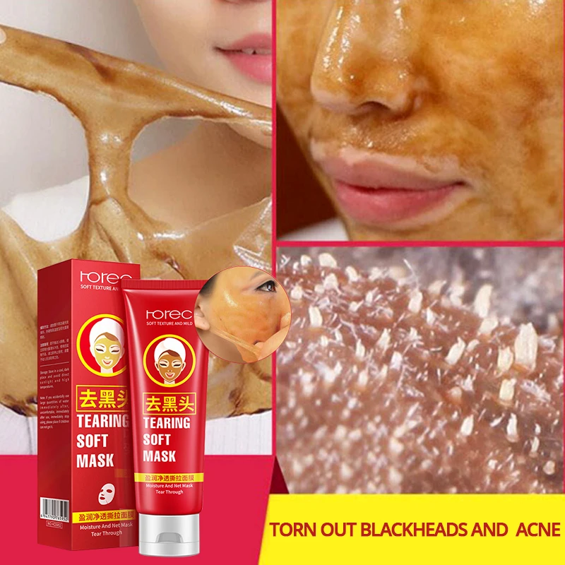 

ROREC Black Head Tear Pull Mask Black Head Nose Film Cream Oil Control To Acne Shrink Pores Black Head Skin Care