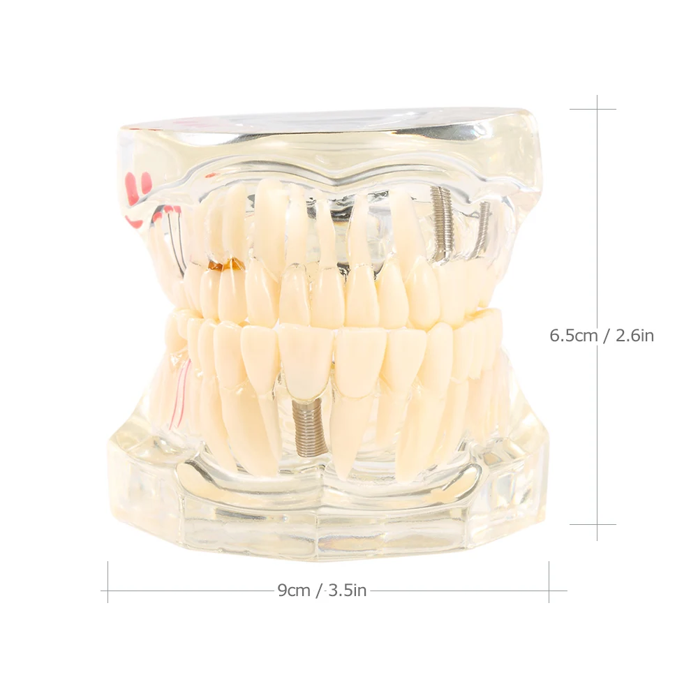 Стоматологическая модель, модель зубов, модель нижней челюсти, стоматологическая имплантация, съемные Обучающие инструменты для зубных зубов, медицинская наука