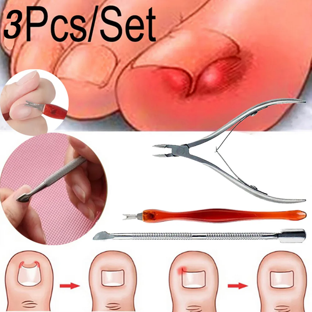 3 шт./компл. вросших ногтей ног коррекции кусачки ножницами фрезы, удаляет мертвую кожу для удаления грязи+ паронихии Подиатрия Педикюр Инструменты для ухода за глазами - Color: 3PCS