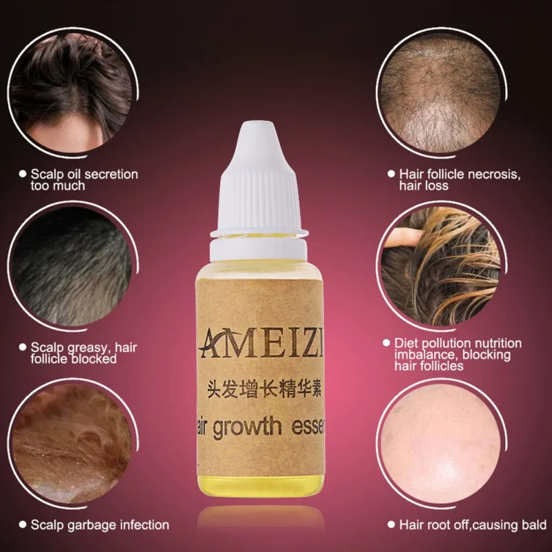 20ml Hair Growth Essence Hair Fast Sunburst Ginger Essence Hair Growth Product Restoration Pilatory