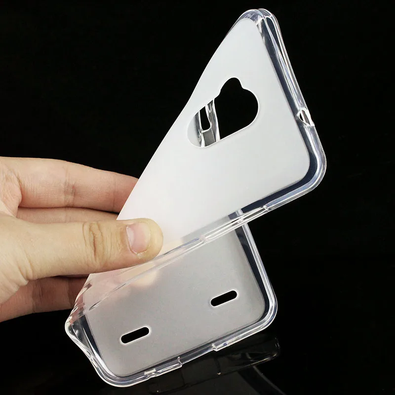 ZTE-1172_2_Soft Skin Gel Silicone TPU Case for ZTE Blade V7 Lite (2)