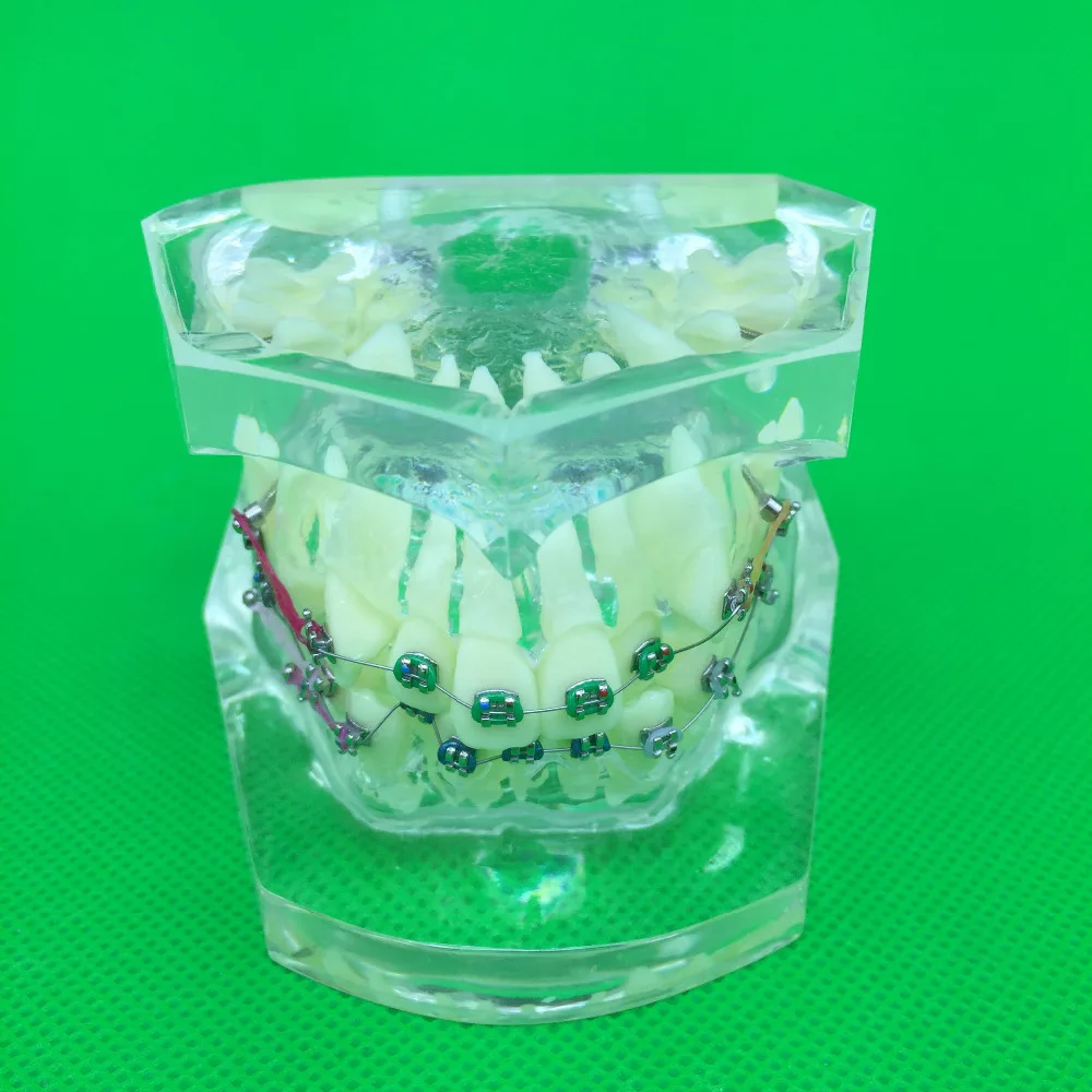 

1PC Dental Orthodontic Study Model Transparent Teeth Malocclusion Orthodontic Model With Colorful Brackets&Hot Sale for Teaching