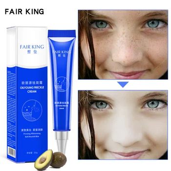 

20g Skin Whitening Fade Cream Lightening Blemish Removal Serum Reduces Age Spots Freckles Dark Spot Corrector Face Cream