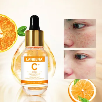 

Vitamin C Serum 40ml Whitening Facial Essence Remover Speckle Fade Dark Spots Brighten Nourishing Face Cream Skin Care 2019