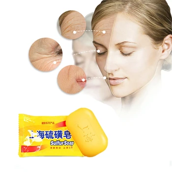 

2019 Cheapest Hotest Newest China Sulfur Soap Skin Conditions Acne Psoriasis Seborrhea Mite Anti Fungus 85g