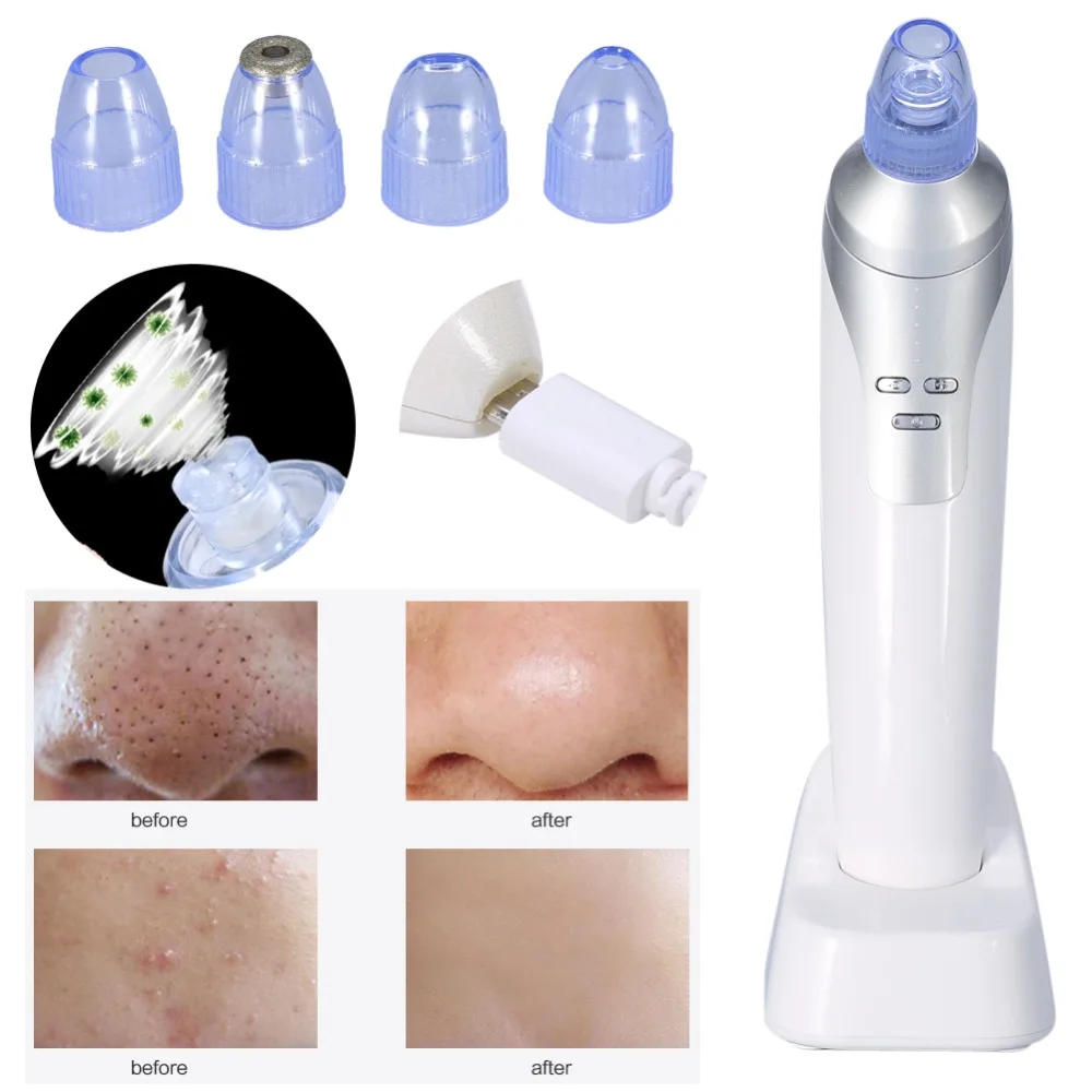 Diamond Dermabrasion Vacuum Pore Cleaner Facial Acne Removal Tool