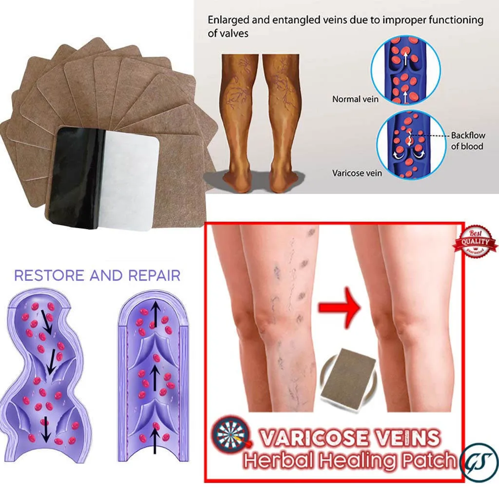 

Leg Foot Massage Stickers Relieve Fatigue Pain Varicose Veins Herbal Healing Patch Varicose Veins Cure Patch Plasters